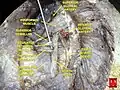 Inferior gluteal artery.
