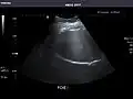 Liver