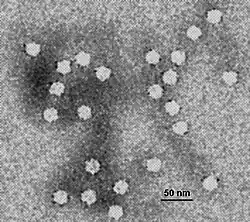 Electron micrograph of canine parvovirus virions