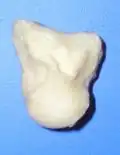 Capitate bone of the left hand. Radial surface (thumb-side surface)