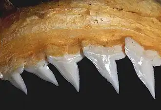 Upper teeth