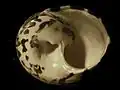view from below; the umbilicus is clearly visible