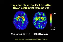 A neurobehavioral syndromic disorder