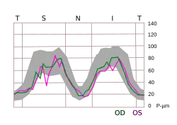 TSNIT graph