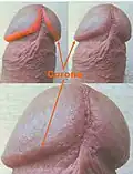 Corona of glans penis