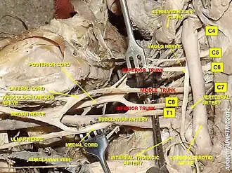 Brachial plexus and axillary artery