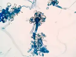 Microscopic image of mould particles.