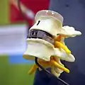 Artificial intervertebral disc