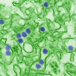 Electron micrograph of "Zika virus". Virus particles (colored purple) are 40 nm in diameter, with an outer envelope and a dense inner core.