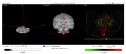 Expression locations of Fam188a in the human brain